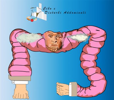 colon irritabile